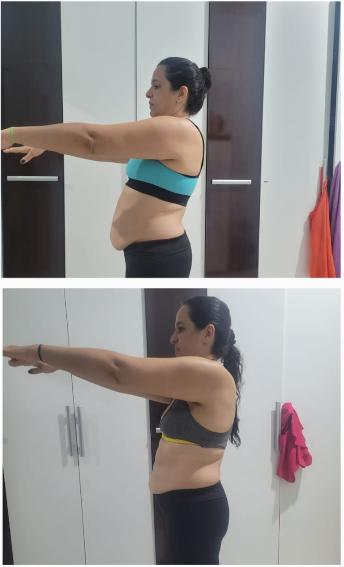 Resultado 3